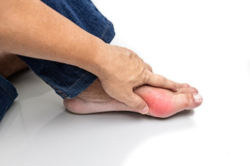 Complications of Gout