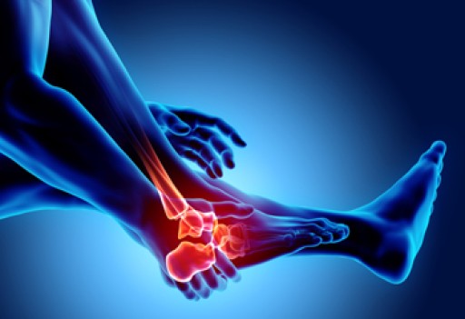 How to Care for Your Arthritic Foot